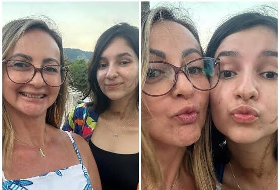 Alana Anísio Rosa sobrevivente de tentativa de FEMINICIDIO